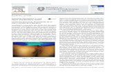 REVISTA DE GASTROENTEROLOGIA DE MEXICO · Revista de Gastroenterología de México. 2014;79:58---60. adjacent to the intergluteal fold. An ultrasound image iden-a hypoechogenic ovoid