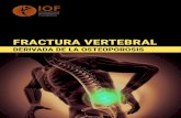 DERIVADA DE LA OSTEOPOROSIS · 2020. 11. 19. · La fractura vertebral (de la columna) derivada de la osteoporosis no solo es una fuente de dolor y discapacidad significativa, sino