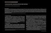 CARCINOMA MICROCÍTICO DE VEJIGA - HPChpc.org.ar/wp-content/uploads/1094-15-FLORES.pdfEl primer caso de carcinoma microcítico de vejiga fue publicado por Cramer et al . 2en el año