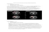  · Web viewadenocarcinoma de recto en febrero de 2018, presentando tumoración a 6 cm de la margen anal que ocupa un tercio de la luz intestinal. La ecografía muestra afectación