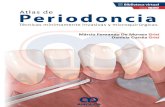 Atlas de Periodoncia · 2020. 7. 1. · sor, prolongando el ligamento periodontal. En algunos meses, el defecto es llenado con ligamento perio-dontal de formación reciente. En la