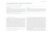 Tomografía de coherencia óptica - Meducatium