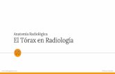 Anatomía Radiológica El Tórax en Radiología