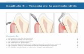 Capítulo 5 – Terapia de la periodontitis