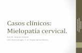 Casos clínicos: Mielopatía cervical.