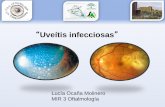 072 Inflamaciones Uveales. Uveitis infecciosas