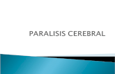 Paralisis cerebral (1)