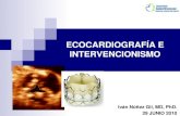 Ecocardiograf­a e Intervencionismo
