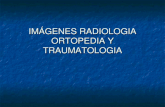 IMGENES RADIOLOGIA ORTOPEDIA Y TRAUMATOLOGIA