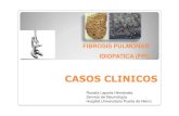FIBROSIS PULMONAR IDIOPATICA (FPI) R+-+Fibrosis...¢  FIBROSIS PULMONAR IDIOPATICA (FPI) CASOS CLINICOSCASO