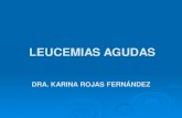 LEUCEMIAS AGUDAS.PDF