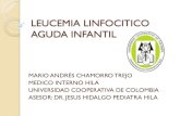 Leucemia linfocitico aguda infantil ucc medicina