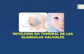 Patologia no tumoral de gl. salivales