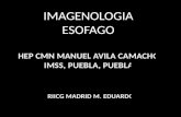 02.imagenolog­a de esofago