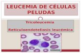Leucemia De Celulas Peludas